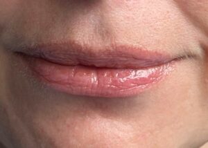 5 mins after the plumping Kbeauty lip balm