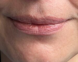 Before applying a Kbeauty lip product on dry lips