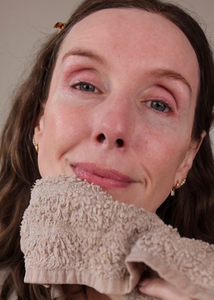 An “after” image showing Amy’s healthy, clean skin and the effectiveness of the cleanser.